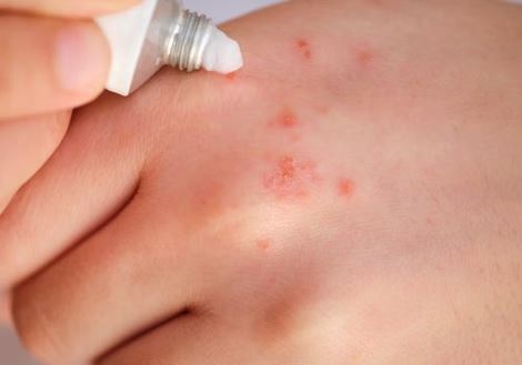 Mofulex Krim