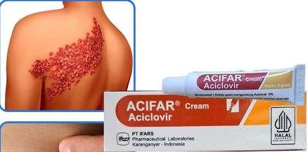 Acifar Cream 5 Gr
